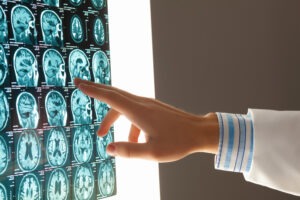 doctor-looking-at-images-of-a-brain-Michigan